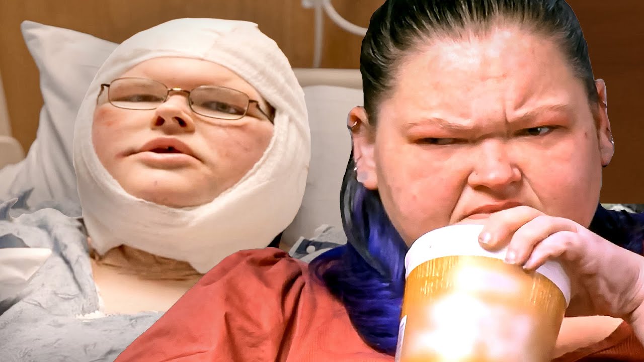 Amy Is Evil And Tammy Gets Skin Removal Surgery