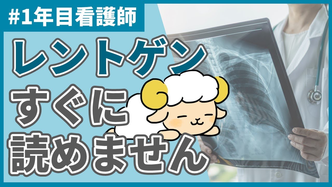 【悲報】あなたがレントゲンをなかなか読めない理由【異常所見まとめ】