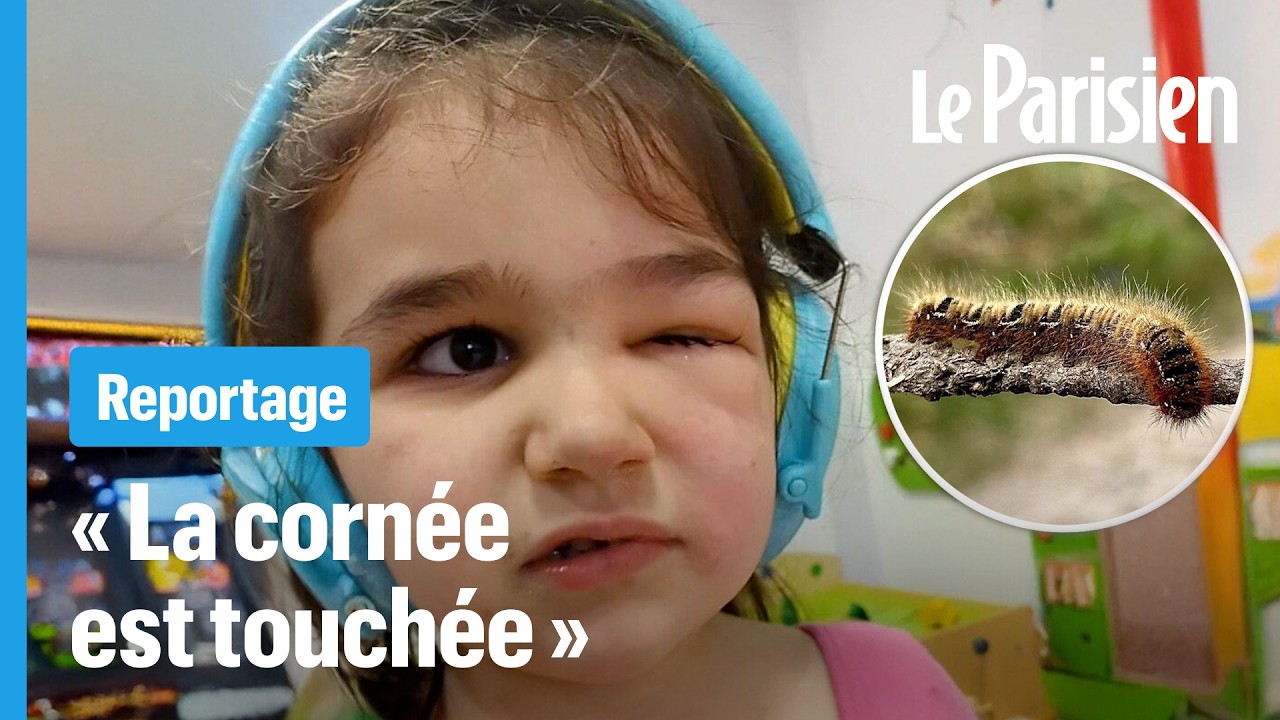Nadia, 4 ans, gravement blessée à l'œil par des chenilles processionnaires