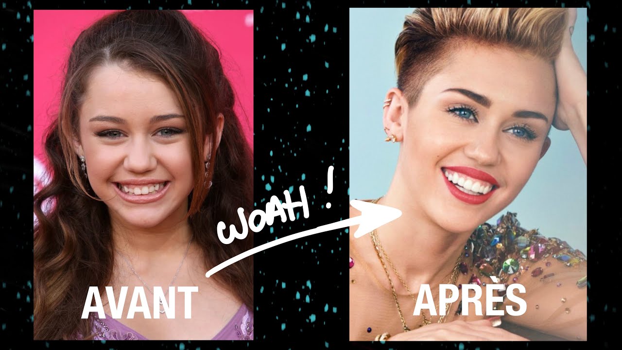 Le secret du sourire des stars !