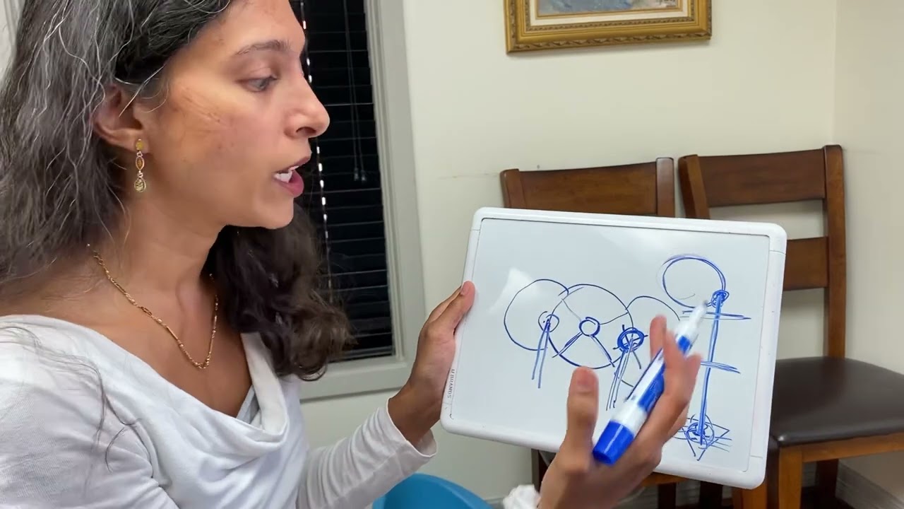 How to fix baby’s flat head without helmet