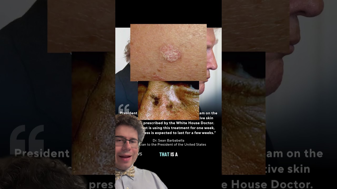 Update on President Trump&rsquo;s rash. What is actinic keratosis? What is 5-FU? #rash #trump #doctor