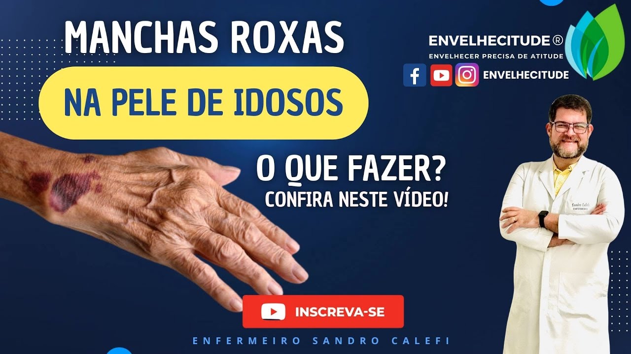 MANCHAS ROXAS NA PELE DO IDOSO: O QUE FAZER?