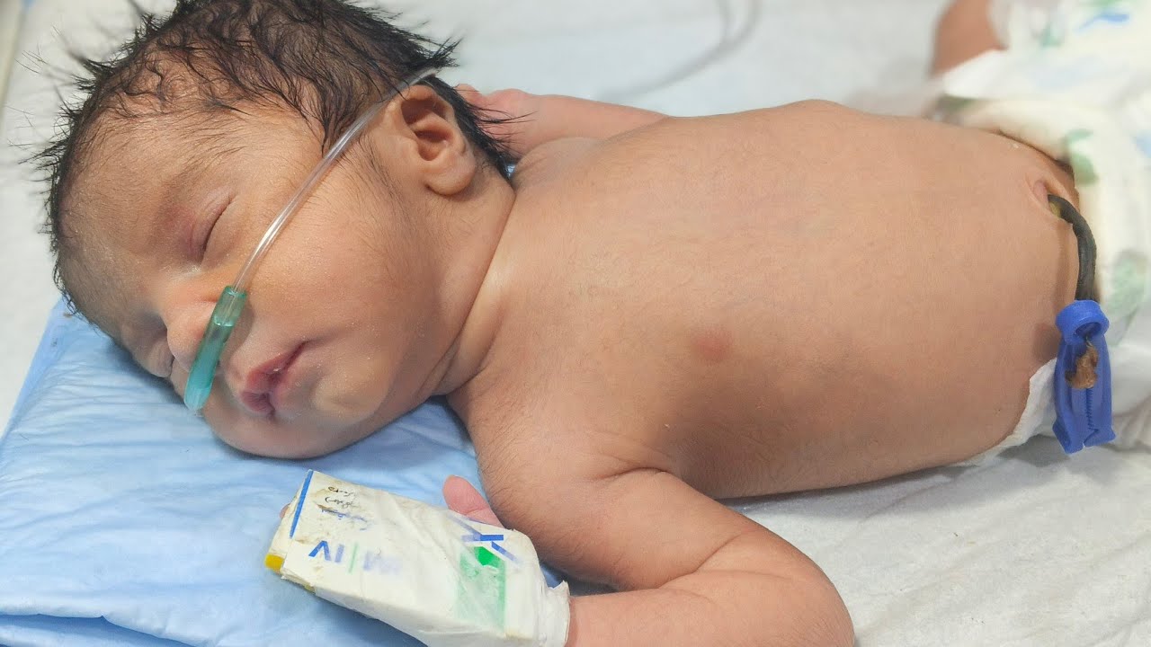 8 Newborn Babies in NICU | Different Diagnoses & Care | Neonatal Observation 🍼