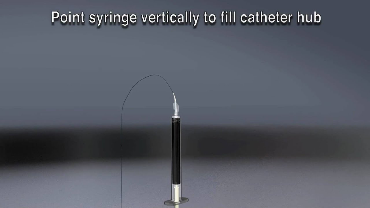 ev3 Onyx Liquid Embolic System