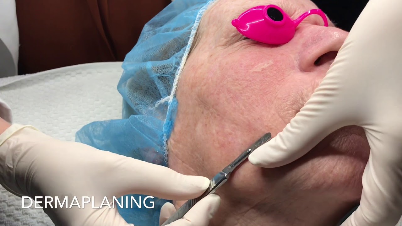 Customized Facial Treatment