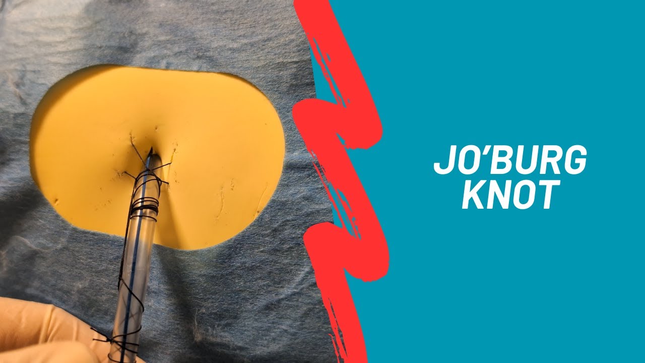 Fissaggio del drenaggio: Jo'burg knot