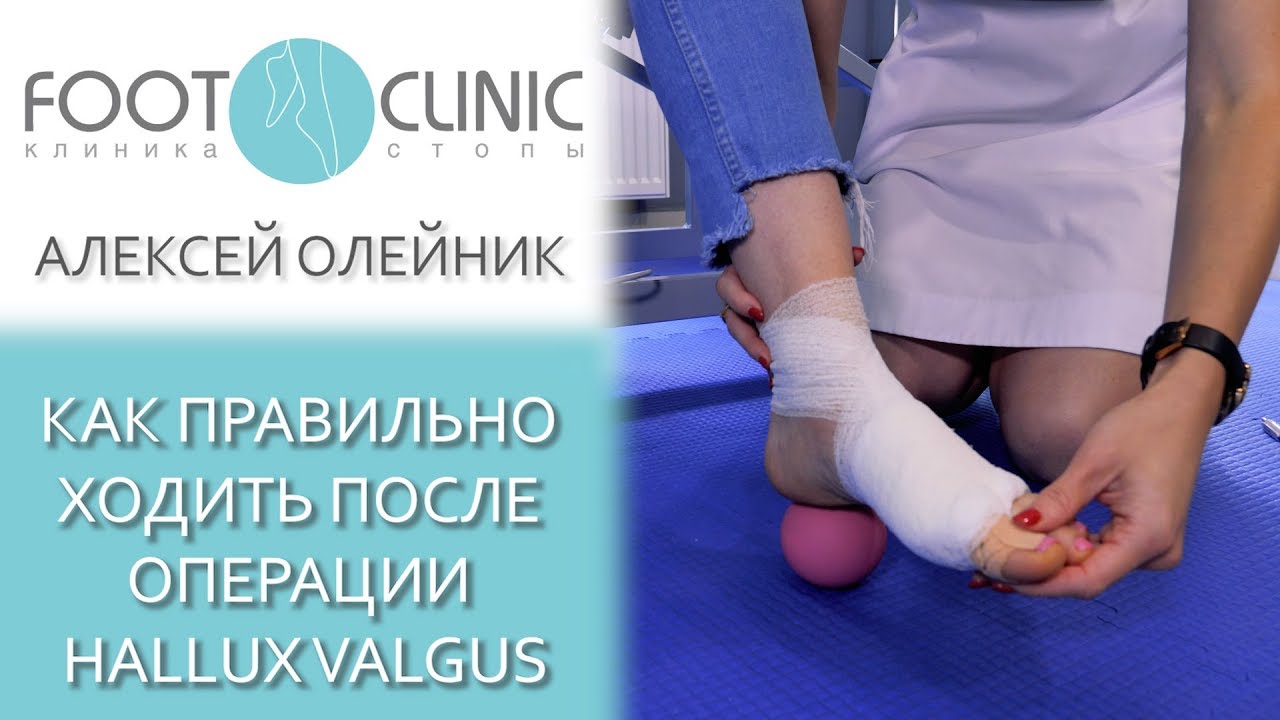 Готовимся правильно ходить после операции #halluxvalgus.