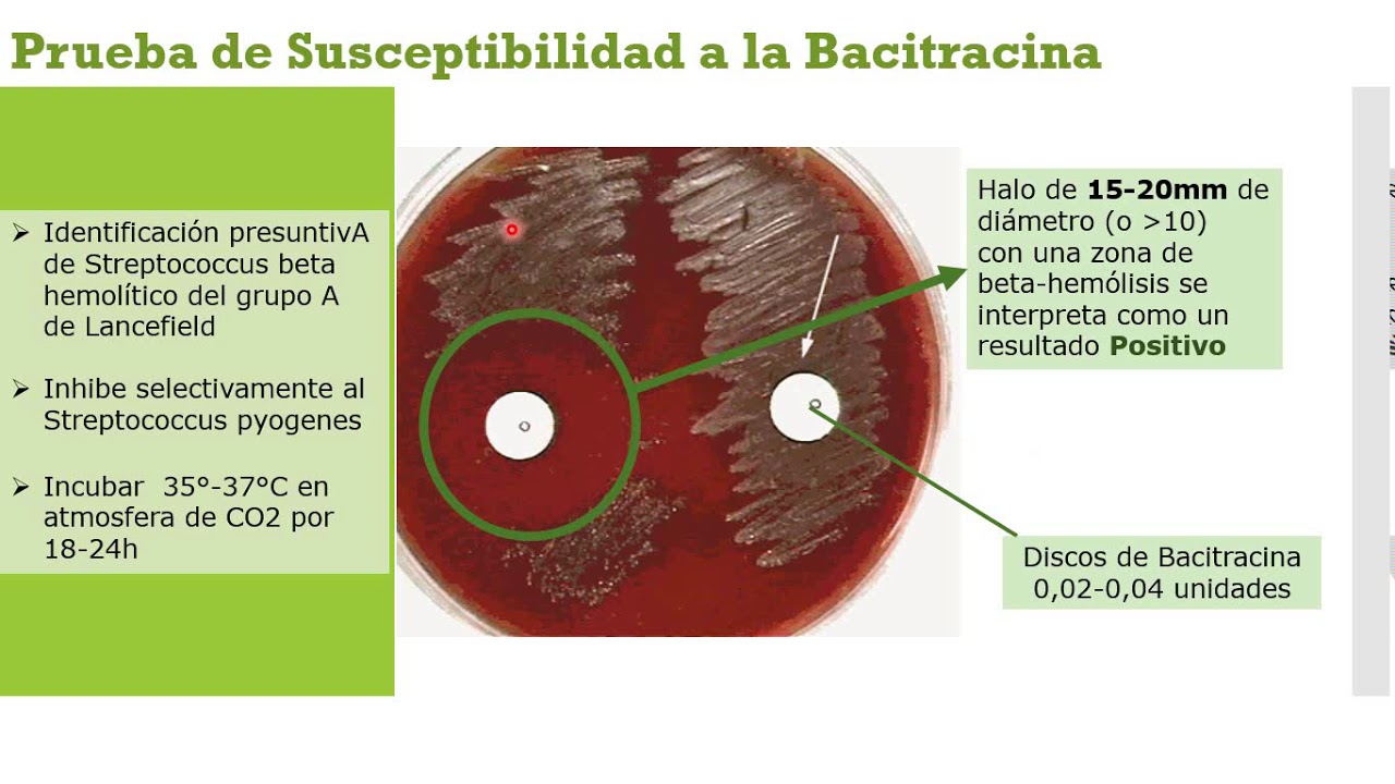 Prueba de Susceptibilidad a ciertas sustancias | Optoquina | Bacitracina | Solubilidad en Bilis |