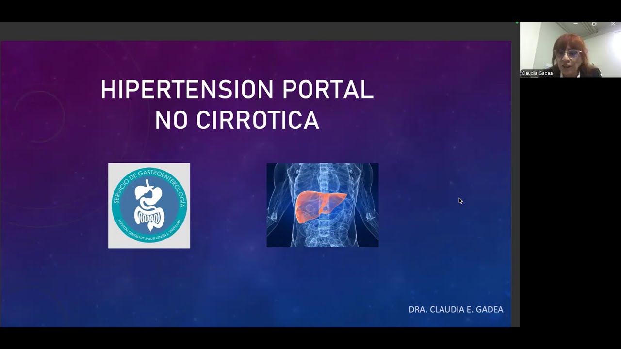 Hipertensión portal no cirrótica