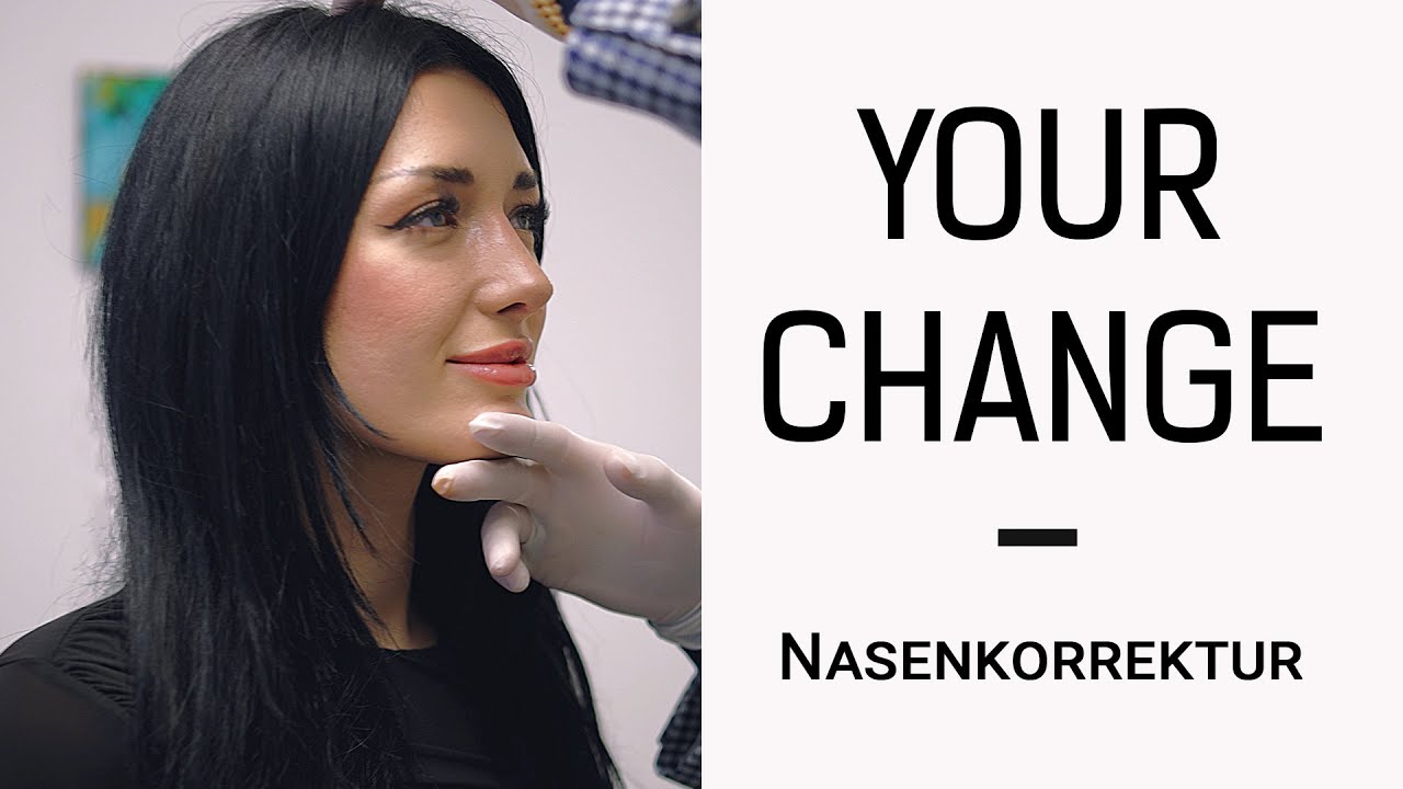 YOUR CHANGE! 12 von 10 😍 – Lauras Nasenkorrektur