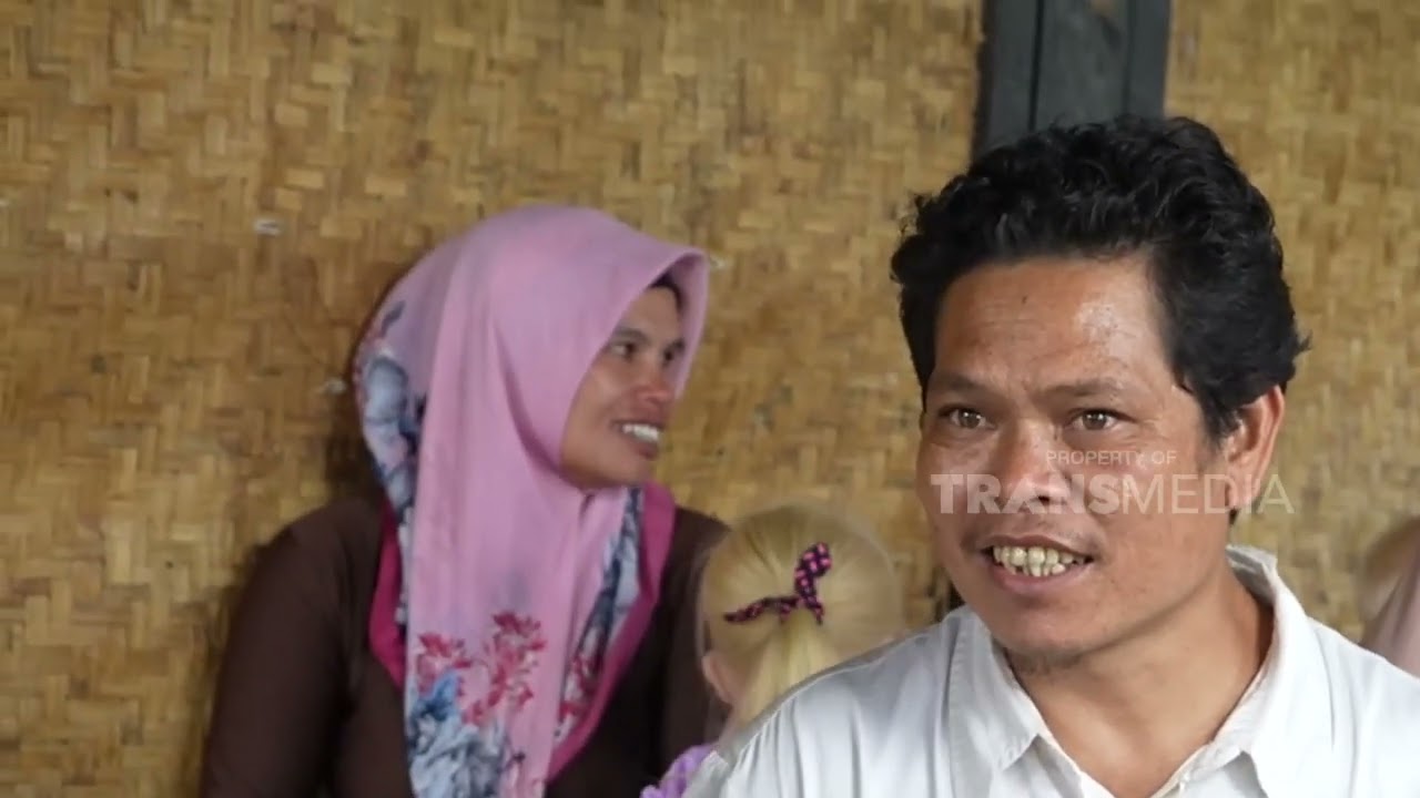 ALBINO, KELAINAN GENETIK YANG DISEBABKAN KEKURANGAN PIGMEN MELANIN | DOKTER TRAVELER (6/2/22) P1