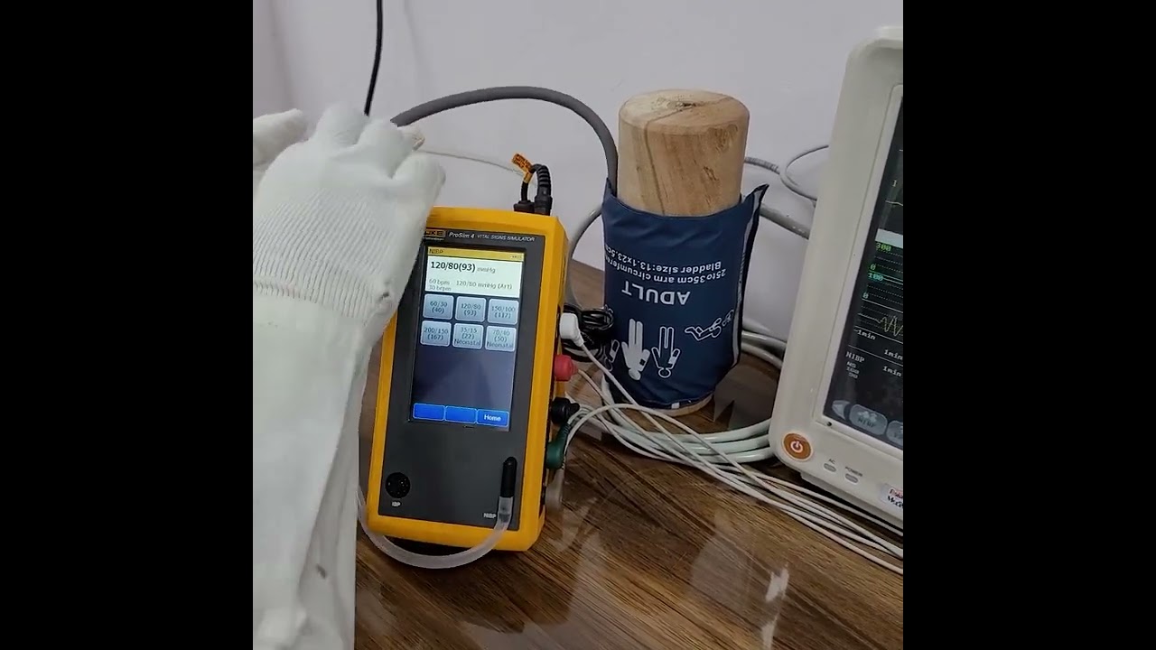 BLOOD PRESSURE ( NIBP ) CALIBRATION IN PATEINT MONITOR BY VITAL/NIBP SIGN SIMULATOR