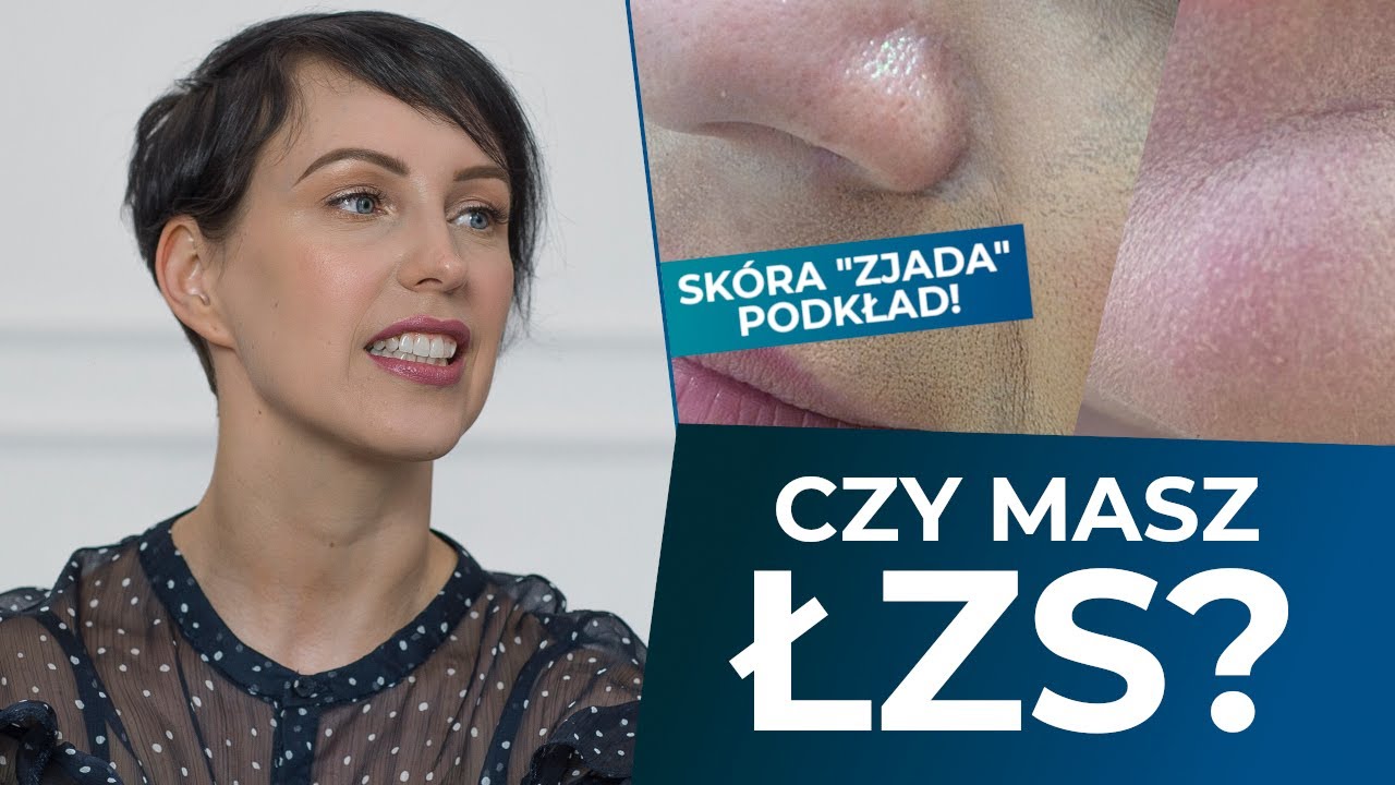 Zaczerwieniona sk&oacute;ra, łuszczące sk&oacute;rki, schodzący podkład. Łojotokowe zapalenie sk&oacute;ry + pielęgnacja!