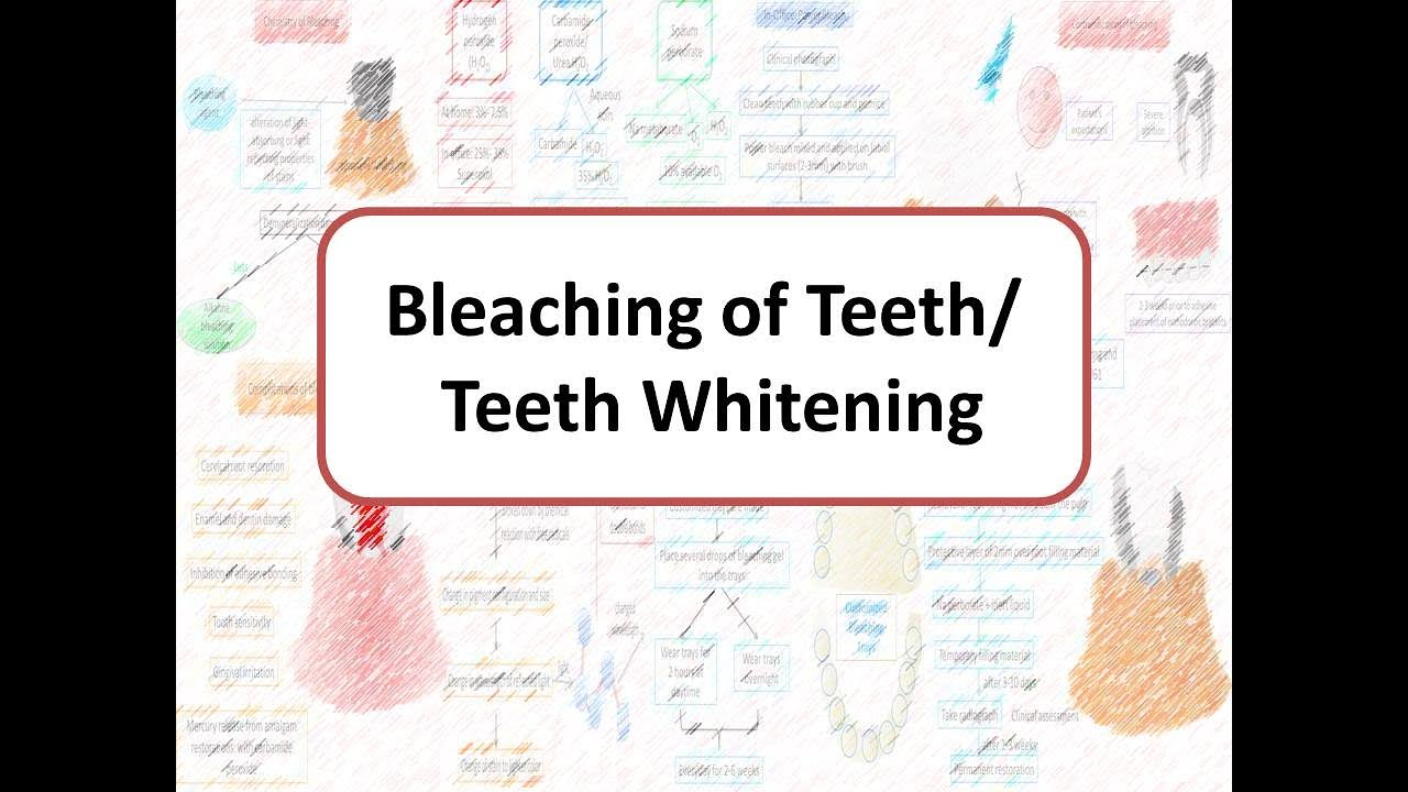 Отбеливание зубов: процесс и меры предосторожности