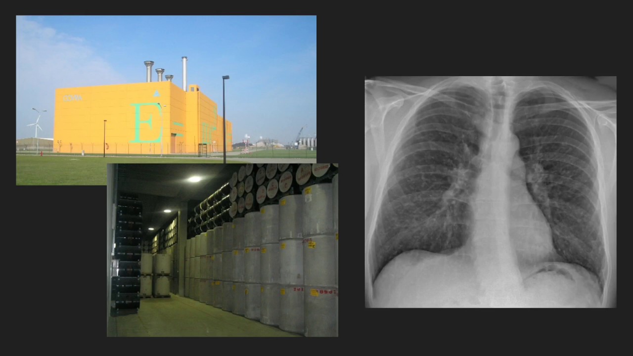 H10.4: Ioniserende straling: Straling en materie