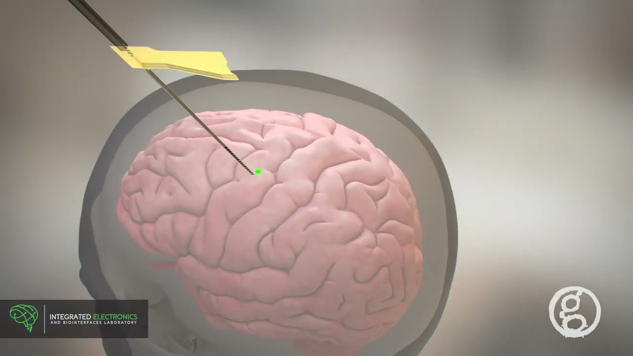Micro-Stereo-Electro-Encephalography (Micro-SEEG) UC San Diego | 2023 Neurology 4K Animation