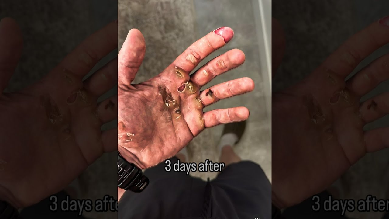 “Bro Got Baby Hands...” 🤦‍♂️