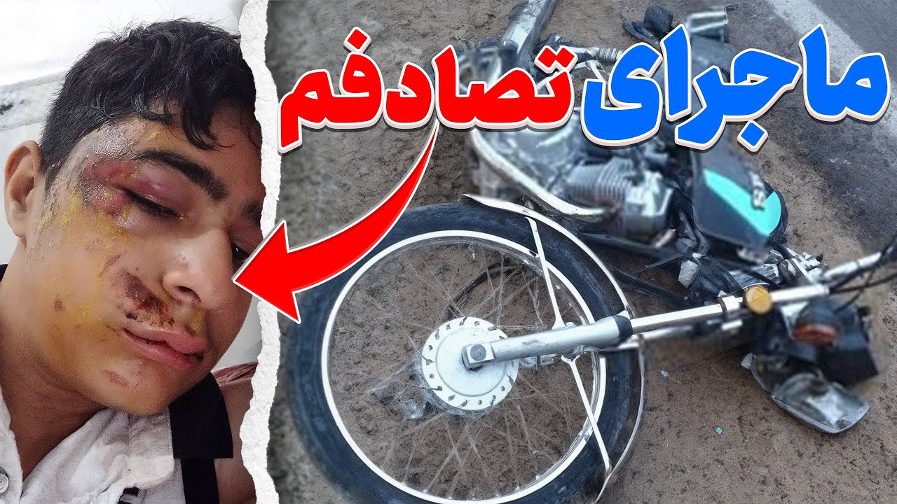 ماجرای تصادفم با موتور توی 15 سالگی 🏍🥲