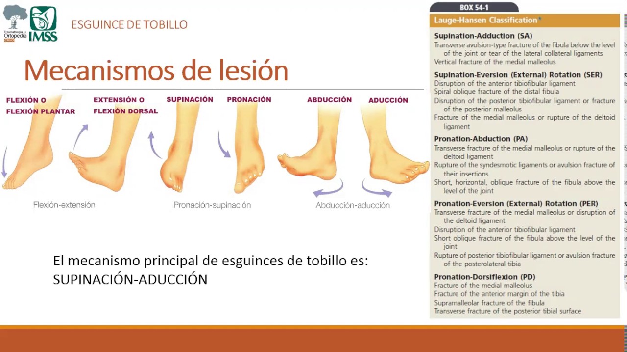 Esguince de Tobillo