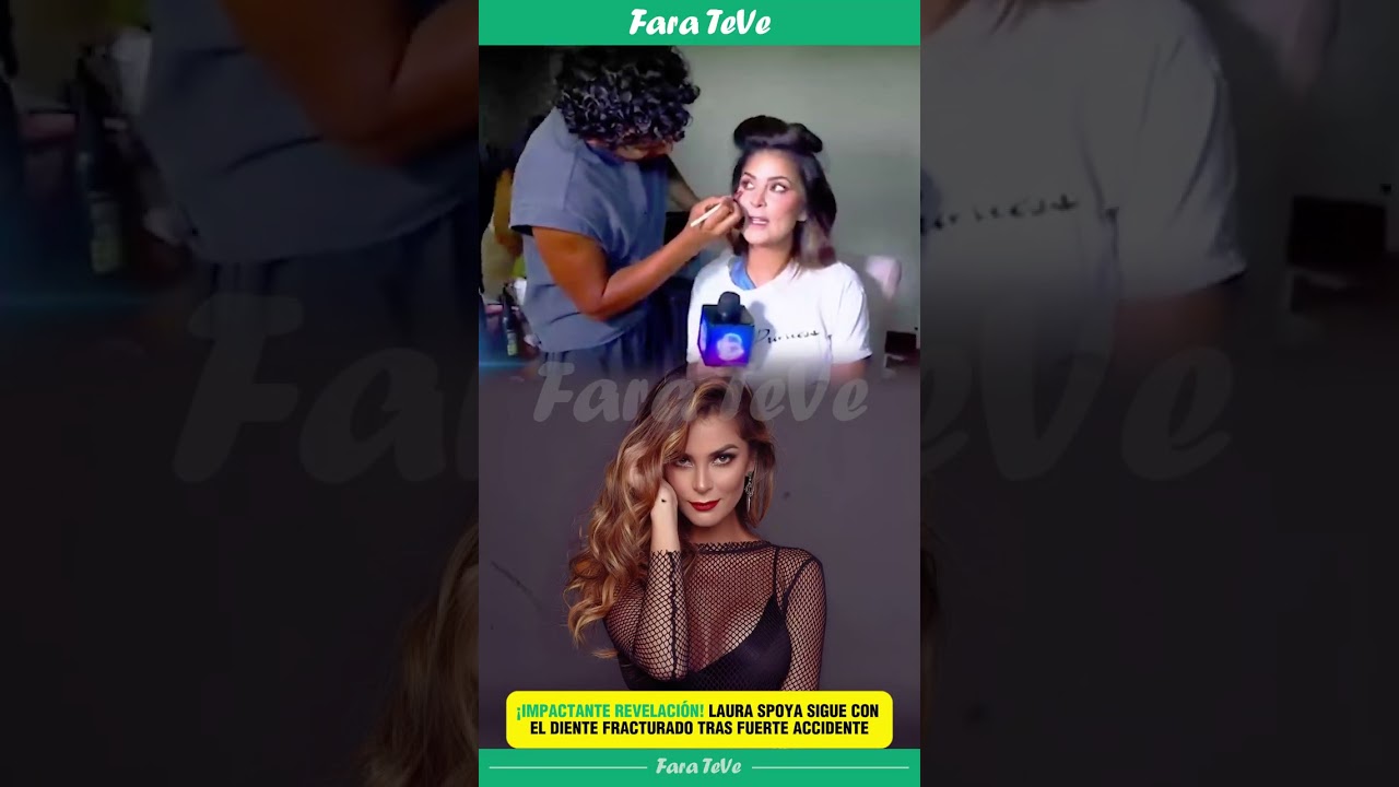 🚨😬 ¡IMPACTANTE REVELACIÓN! LAURA SPOYA SIGUE CON EL DIENTE FRACTURADO TRAS FUERTE ACCIDENTE 😱🚗