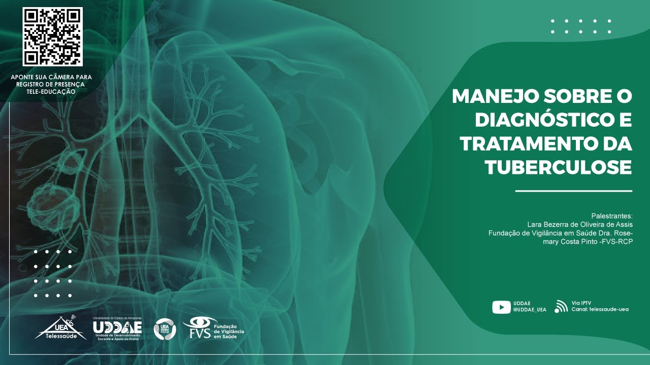 FVS - Tema: Tuberculose (Manejo sobre o diagnóstico e tratamento da Tuberculose)