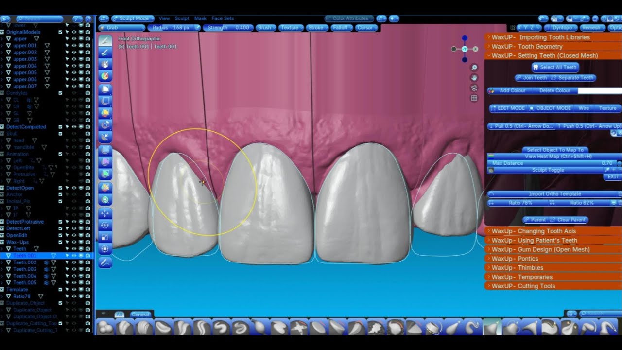Dental Veneers: Guide to a Perfect Smile | CAD/CAM Workflow