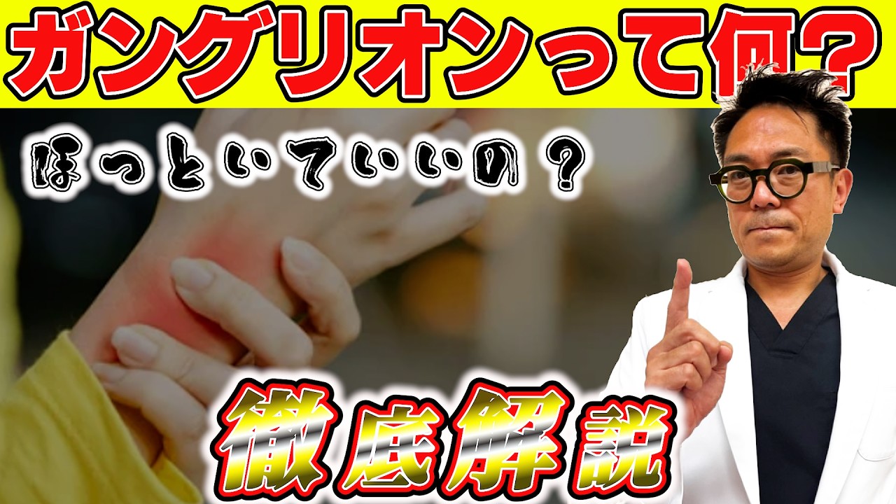手首のしこり ガングリオンはこうして治す | 専門医が教える治療法と絶対にやってはいけない〇〇