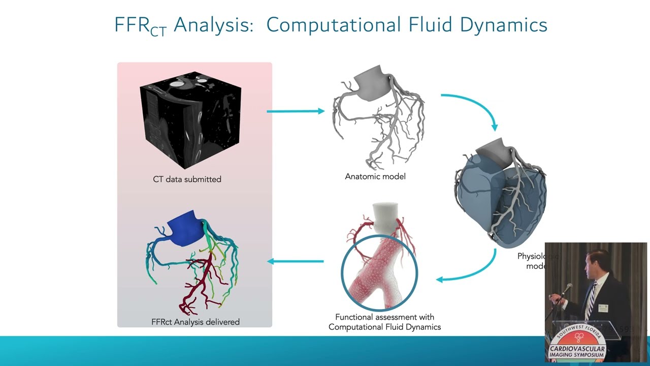 Dr. Maroules Discusses CT-Based FFR at the 2025 Southwest Florida Cardiovascular Imaging Symposium