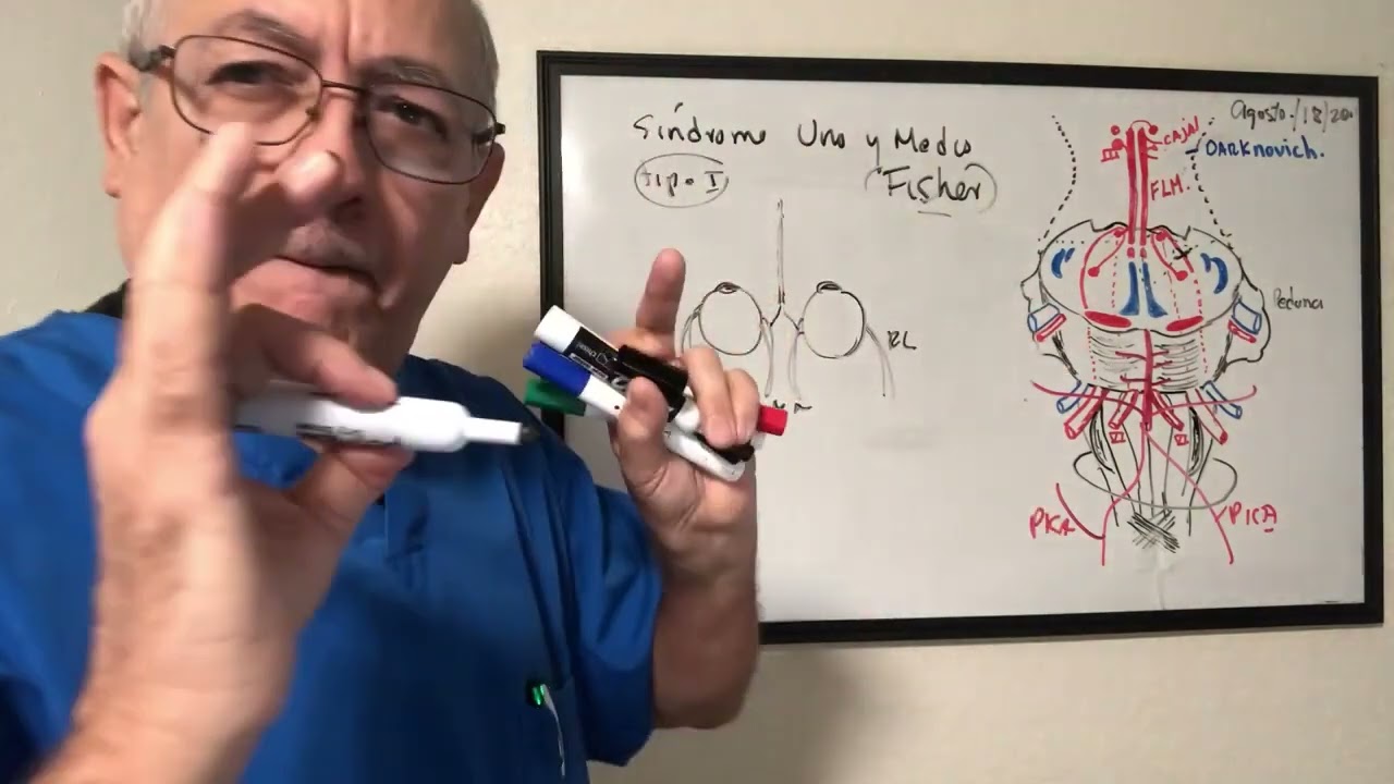 Sindrome Uno y medio de Fisher, pontino dorsocaudal paso a paso