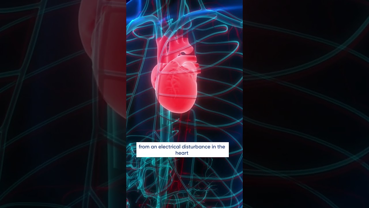 What is Cardiac Arrest? #Shorts