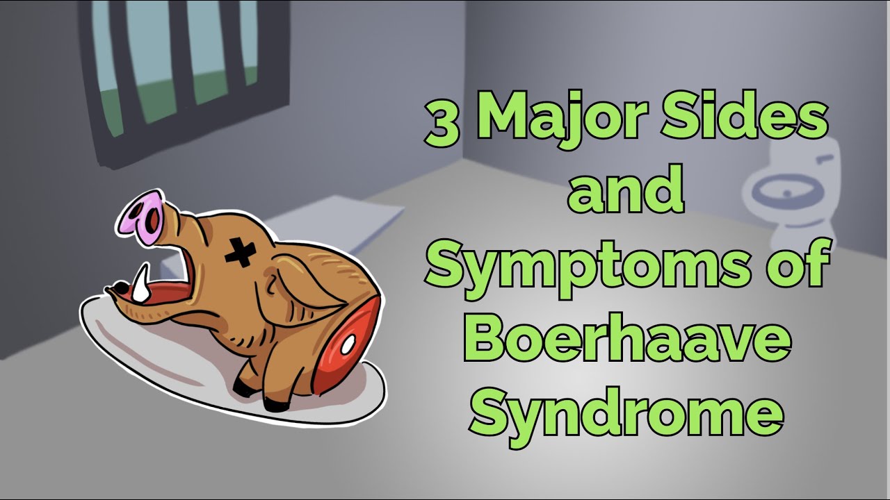 3 Major Sides and Symptoms of Boerhaave Syndrome (Step 1, COMLEX, NCLEX&reg;, PANCE, AANP)