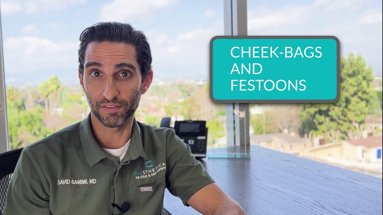 Dr. David B. Samimi, MD Discusses Cheek Bags & Festoons | Eyesthetica | Los Angeles, CA