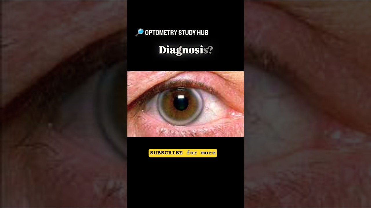 clinical Optometry cases 