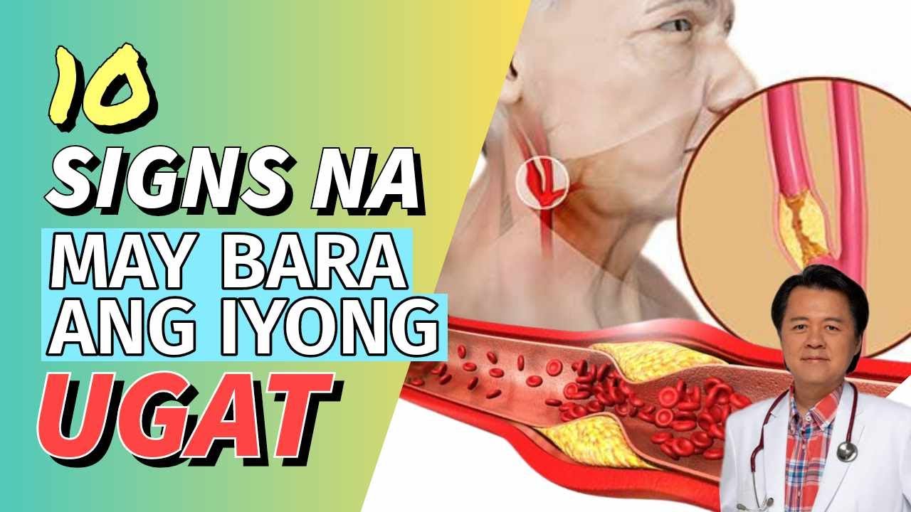 10 Senyales na May Bara ang iyong Ugat. By Doc Willie Ong