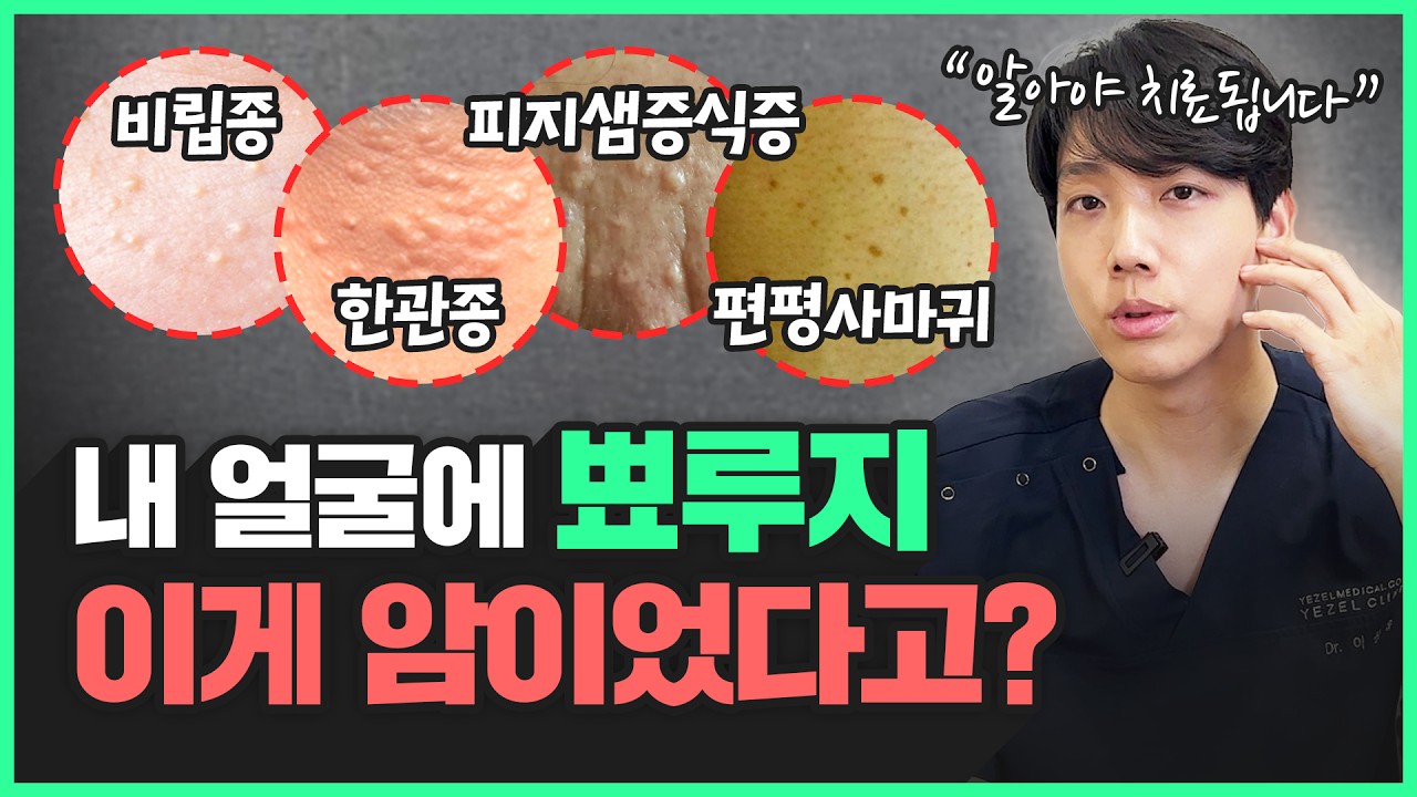내 얼굴에 '이것' 뭔지는 알고 가세요... 