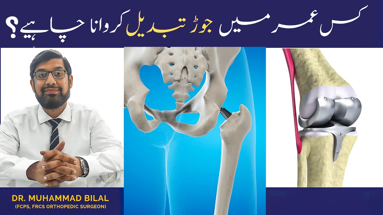 Age for Joint Replacement in Urdu Hindi | Dr. Muhammad Bilal Orthopedic Surgeon