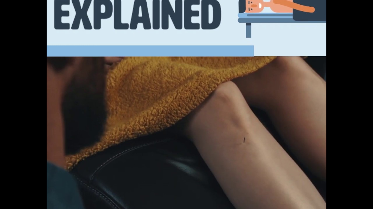 Acupuncture Explained