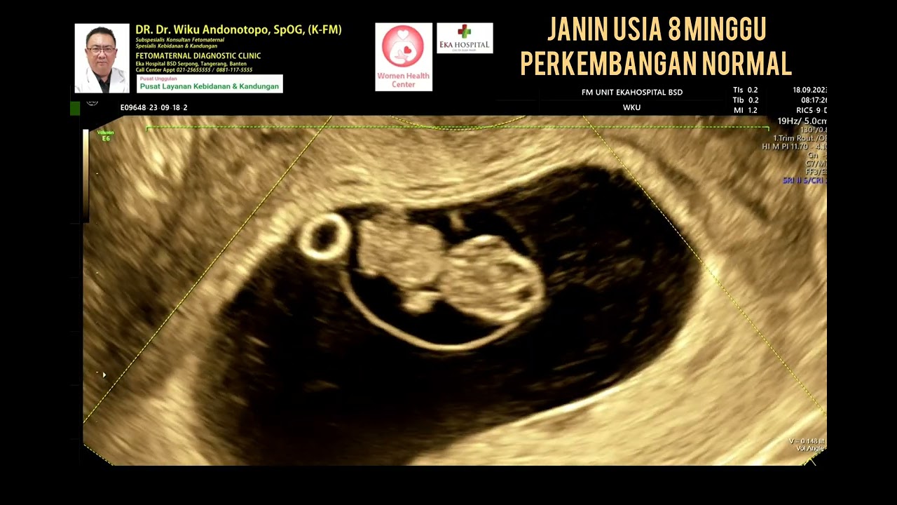 Kehamilan usia 8 minggu normal
