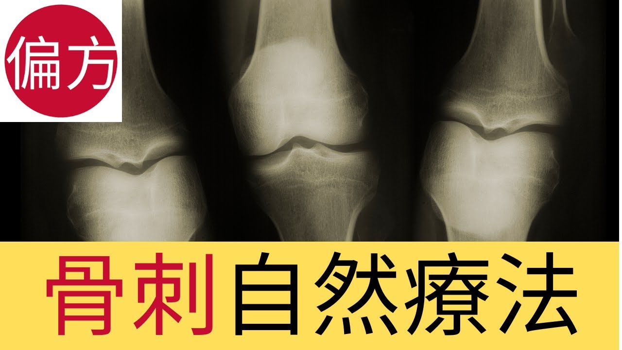 骨刺 自然療法
