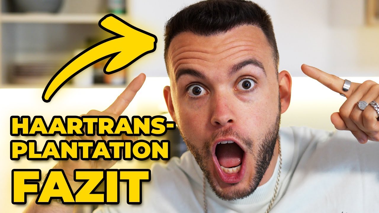 ENDLICH NEUE HAARE | Haartransplantation Elithair Istanbul