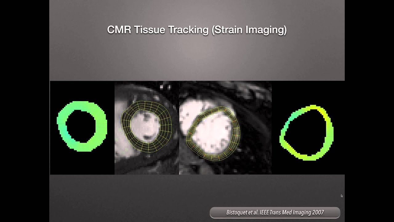Can-SCMR Lecture Series - Dr Matthias Friedrich, Oct 9, 2015