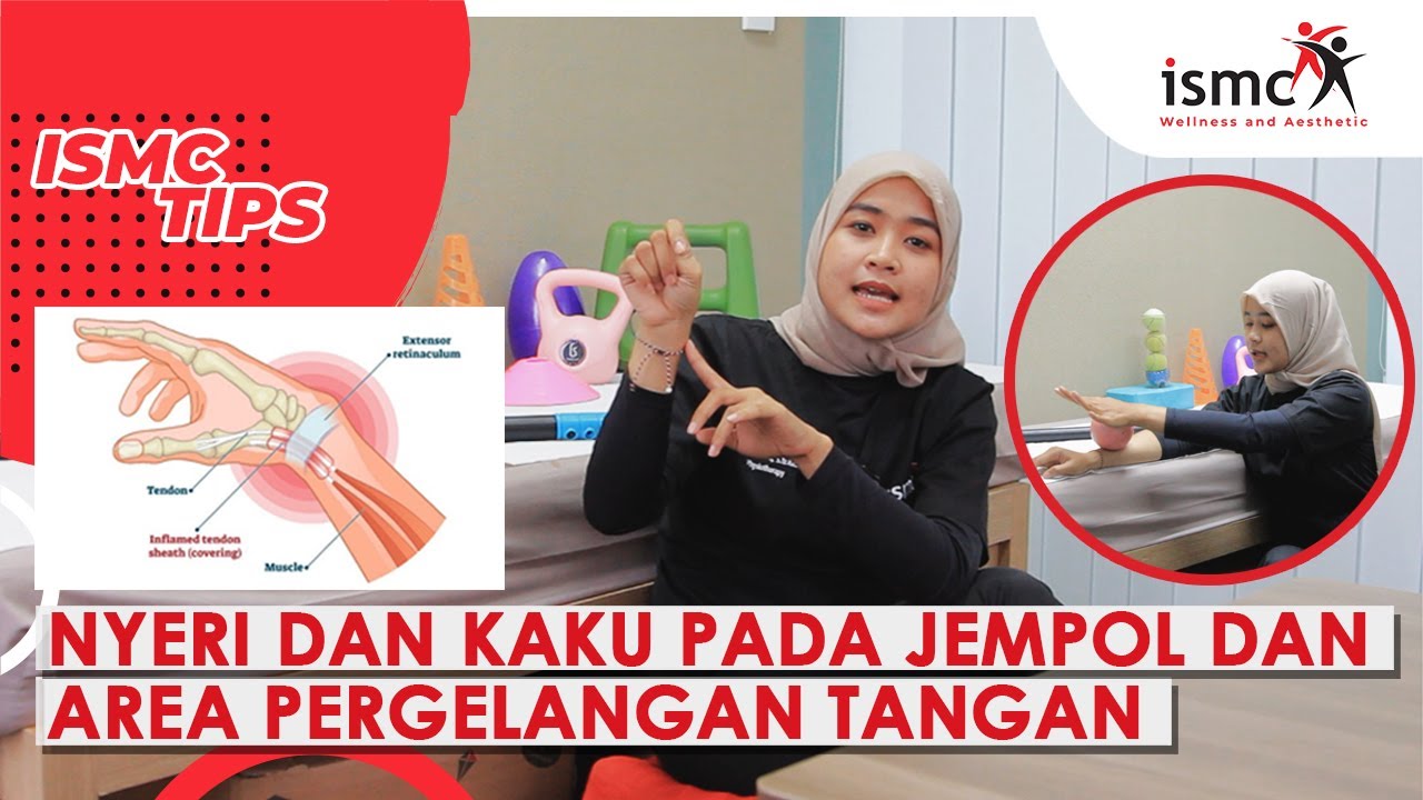 ASSESMENT DAN PENANGANAN NYERI DAN KAKU PADA JEMPOL DI SEKITAR PERGELANGAN TANGAN | DE QUERVAIN