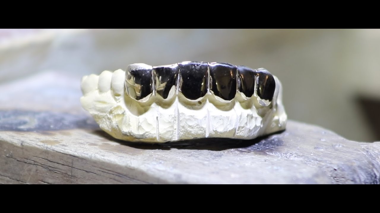 Making a Custom Gold Grill