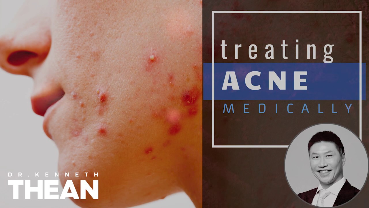 Treating Acne Medically | Dr. Kenneth Thean