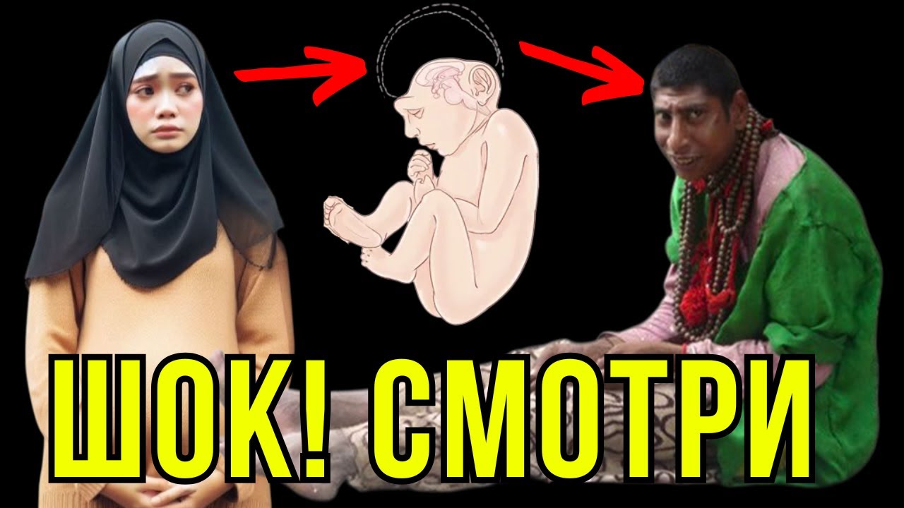 Почему пакистанки рожают ТАКИХ детей? Страшная правда