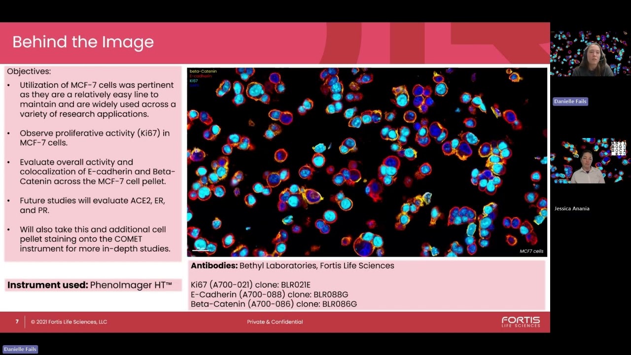 Cells in Focus: Danielle Fails on MCF-7 Cell Activity & Marker Expression | June 2025 Feature.