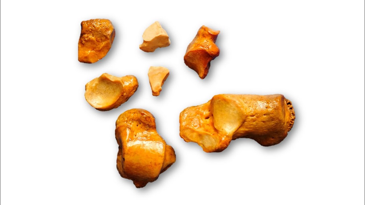 Tarsal Bones