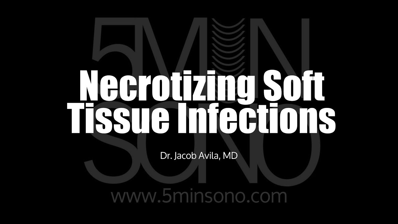 Necrotizing Soft Tissue Infection