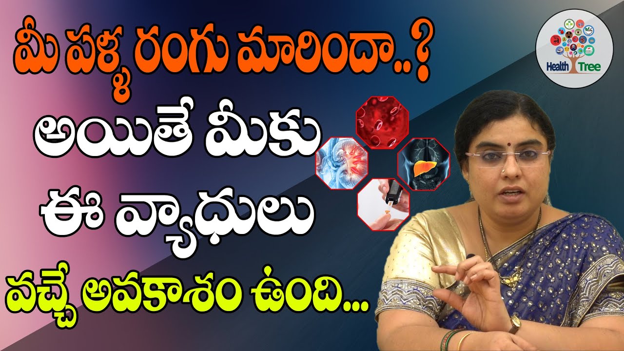 Discoloration Of Teeth | What Happens If You Have Discoloured Teeth | Unani - Dr. Satya | HealthTree